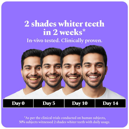 Perfora Purple Teeth Whitening Toothpaste Serum | Color Corrector Purple Toothpaste | Tooth Stain Removal | Enamel Safe & Effective Teeth Whitener | Apple Peach Flavor - 30 Millilitre