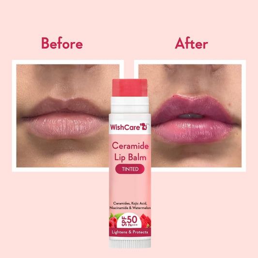 WishCare Tinted Ceramide Lip Balm with SPF50 PA+++ - Kojic Acid & Niacinamide - For Lip Lightening & Protection 5gm