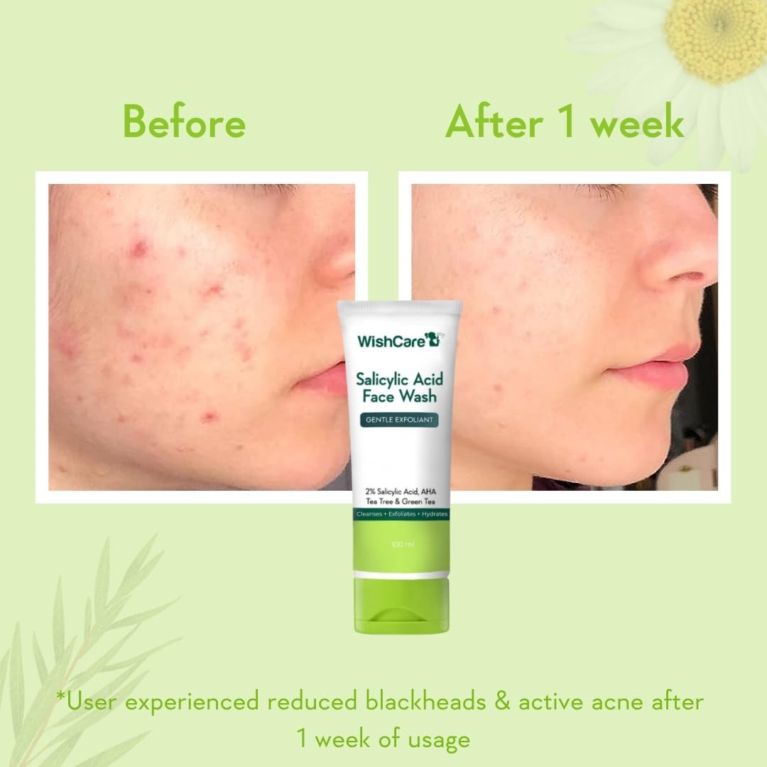WishCare Salicylic Acid Face Wash For Women & Men | Reduces Acne & Controls Oil | With AHA, Green Tea, Chamomile & Tea Tree | Salicylic Acid Face Wash For Oily Skin & Acne Prone Skin | 100ml