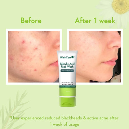 WishCare Salicylic Acid Face Wash For Women & Men | Reduces Acne & Controls Oil | With AHA, Green Tea, Chamomile & Tea Tree | Salicylic Acid Face Wash For Oily Skin & Acne Prone Skin | 100ml