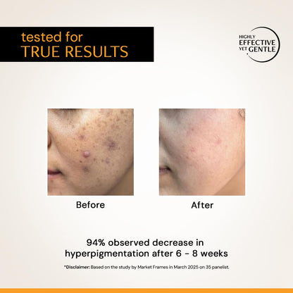 Deconstruct 10% Vitamin C Serum | Non-Irritating & Non-Sticky | Tested for Oily, Sensitive Skin | Beginner-Friendly| Brightens Dull Skin, Evens Tone | No Purging | With 0.5% Ferulic Acid|30ml