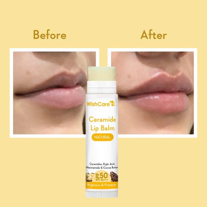 WishCare Ceramide Lip Balm SPF 50 PA+++ | Brightening Lip Balm for Dark Lips | In-Vivo Tested | Kojic Acid & Niacinamide | Natural & Untinted | For Women & Men | 5g