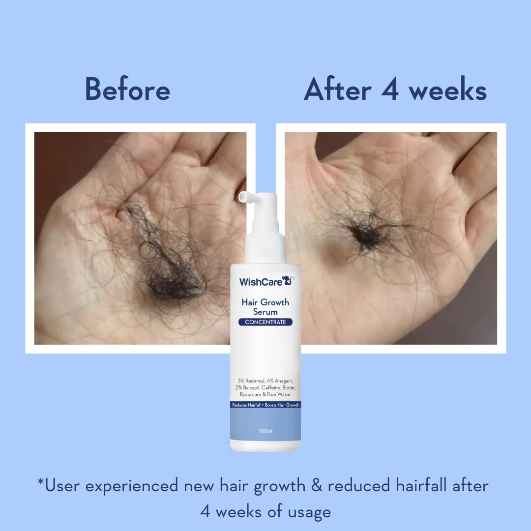 WishCare Hair Growth Serum For Scalp | 94% Saw New Hair Growth | Redensyl & Rosemary Oil | 100% Saw Hairfall Reduction | In-Vivo Tested | For Men & Women | 100ml