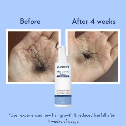 WishCare Hair Growth Serum For Scalp | 94% Saw New Hair Growth | Redensyl & Rosemary Oil | 100% Saw Hairfall Reduction | In-Vivo Tested | For Men & Women | 100ml