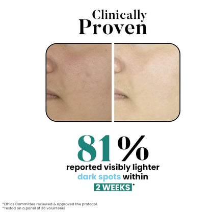 Bio Code 2% Tranexamic Acid & 5% Vitamin C Radiance Renewal Serum (30ml) â€“ with 3% Niacinamide, 1.5% Hyaluronic Acid & 0.5% Vitamin E | Dermatologist Recommended