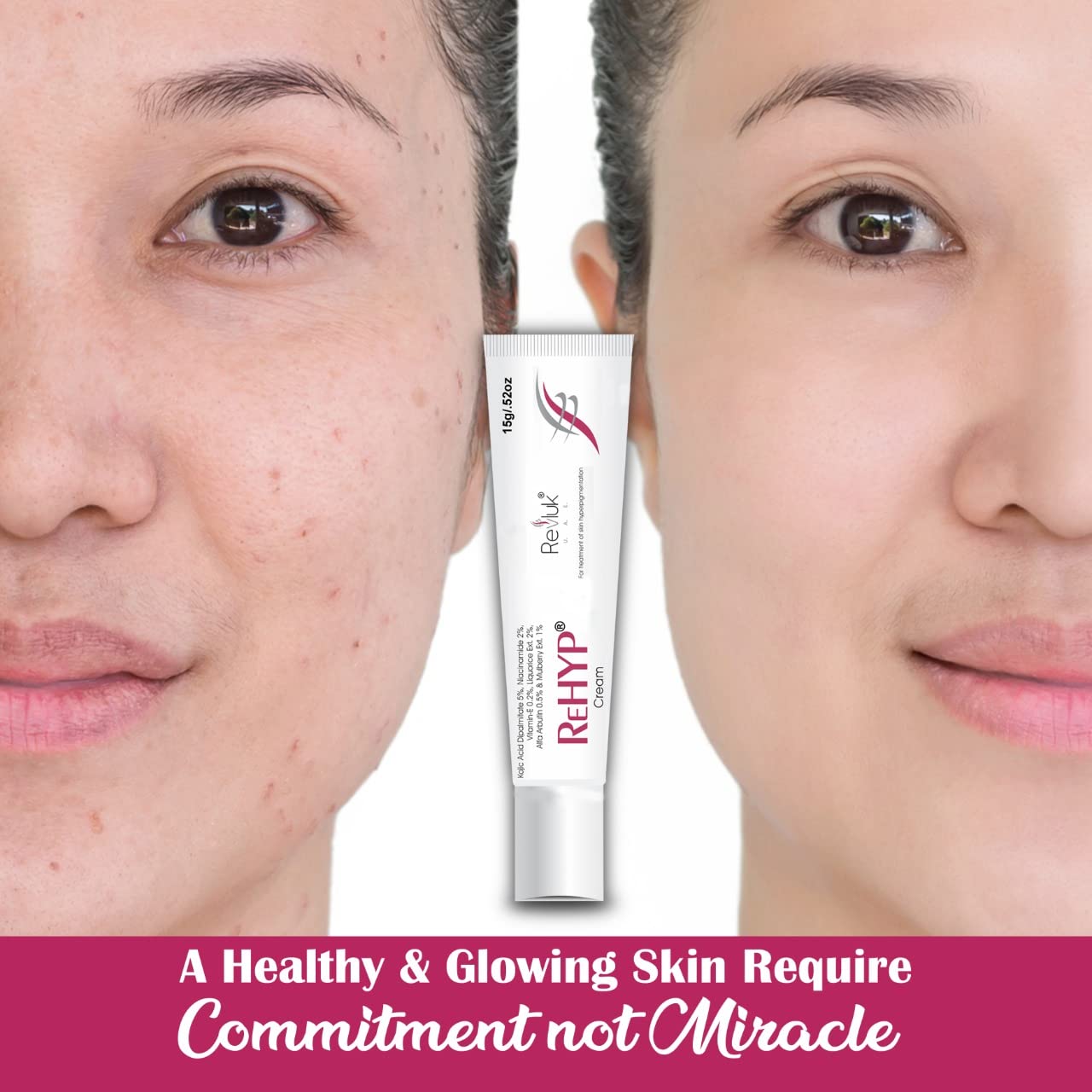 Rehyp Pigmentation Cream for Women â€“ Dark Spot Remover, Brightening Face Cream with Kojic Acid & Alpha Arbutin â€“ Paraben-Free, Dermatologically Tested â€“ 15g