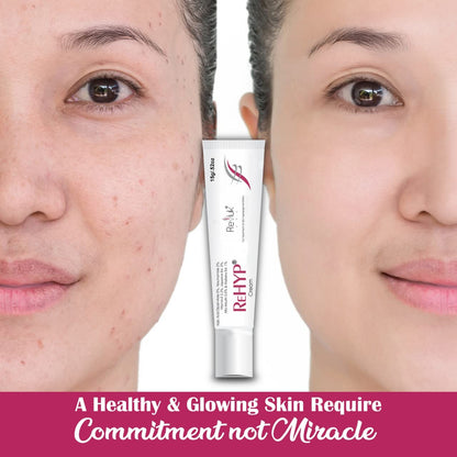 Rehyp Pigmentation Cream for Women â€“ Dark Spot Remover, Brightening Face Cream with Kojic Acid & Alpha Arbutin â€“ Paraben-Free, Dermatologically Tested â€“ 15g