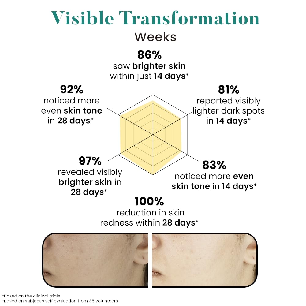 Bio Code 2% Tranexamic Acid & 5% Vitamin C Radiance Renewal Serum (30ml) â€“ with 3% Niacinamide, 1.5% Hyaluronic Acid & 0.5% Vitamin E | Dermatologist Recommended
