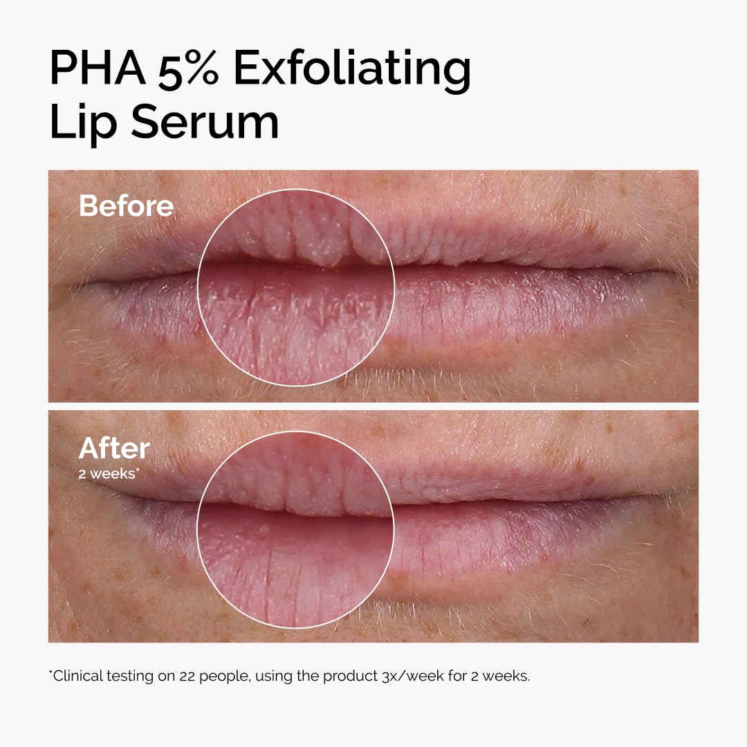 The Ordinary PHA 5% Exfoliating Lip Serum, Hydrating Overnight Lip Exfoliator Treatment, 15ml