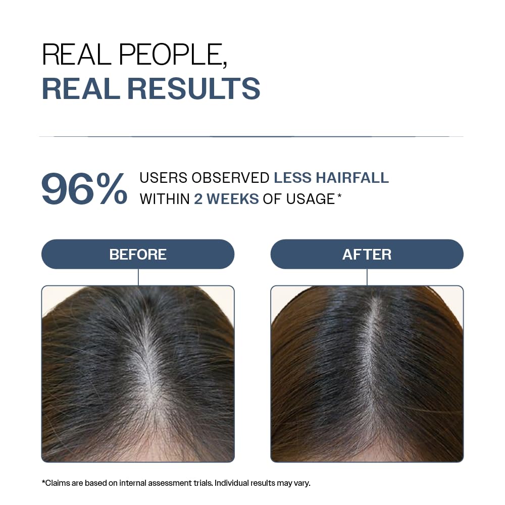 Bare Anatomy Anti Hair Fall Shampoo | 5x Hair Fall Control & Growth|Contains Biotin Adenosine, & Peptides | Rosemary, Rice Water, Hyaluronic Acid | For All Hair Types | For Women & Men | 250ml