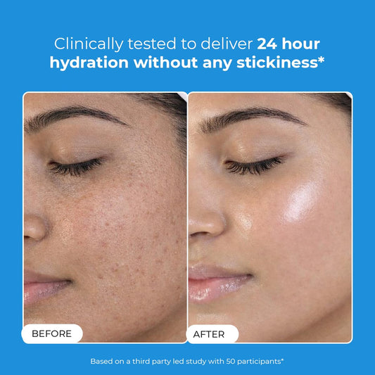 Conscious Chemist Hyaluronic Acid Moisturizer | 100g | Moisturizer for Dry Skin Face, Ceramide Moisturizer, Face Cream for Men & Women, Treat Dull, Dehydrated Skin, For Normal to Dry Skin - Hydro+