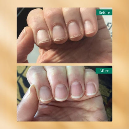 RAS Luxury Oils Nailchemy Nail Strengthening Serum | Nail Growth & Repair Serum for Healthy, Long Nails | Keratin & Collagen Formula for Brittle & Damaged Nails | Nail Growth & Strengthener