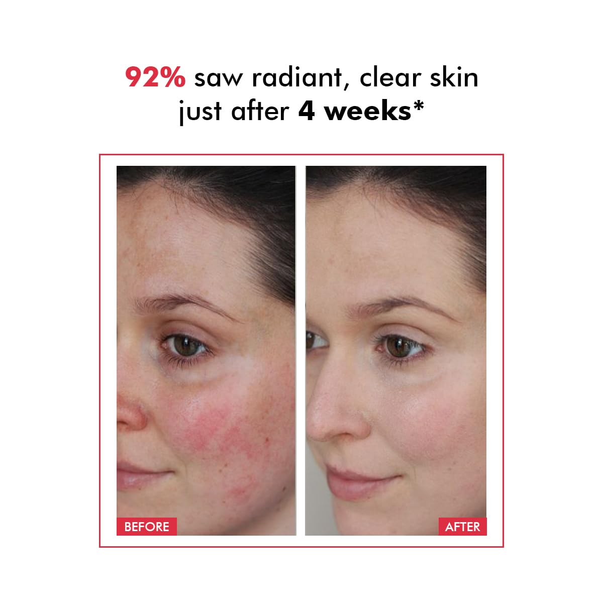 Conscious ChemistÂ® 25% AHA, 2% BHA, 5% PHA Peeling Solution | 30ml | Advanced Resurfacing AHA BHA Peeling Solution, Anti Aging Serum, Exfoliating Face Serum for Men & Women - Derm Date
