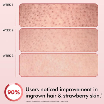 mCaffeine 11% AHA BHA Strawberry Body Lotion for Skin Smoothening | Gently Exfoliates Dead, Dry, Even Tones Skin | 72hr Moisturization | Juicy Strawberry Scent, For Men & Women-200ml
