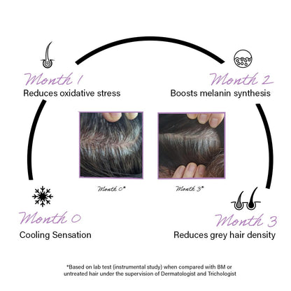 Rootcos ArcolysÂ® Anti grey hair serum with MelanograyTM | Reverses & limits hair greying | Toxin Free | Light-weight, Non-sticky & Odourless formula | For all hair types | 50 ml