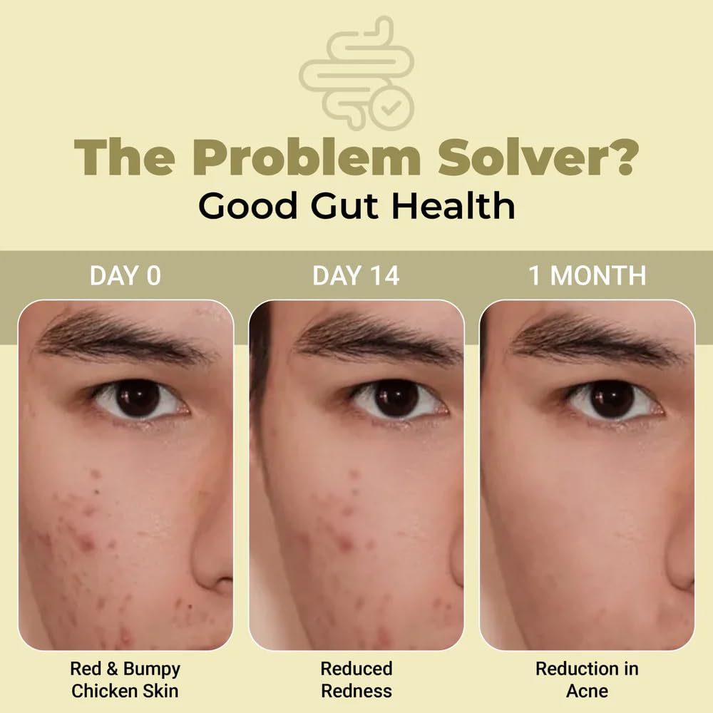 Cureveda SkinGut Pre & Probiotic Powder for Clear Skin | Supports Acne Control | Gut Health| Skin Detox | Plant-Based Formula with Antioxidants | No Added Sugar & Artificial Flavour(150 gm)