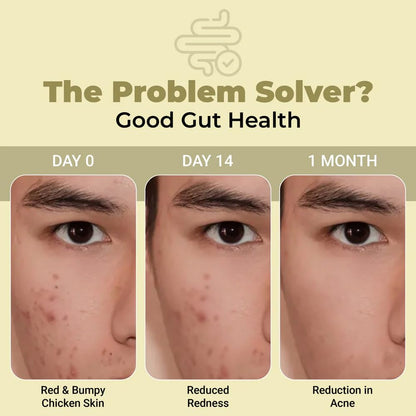 Cureveda SkinGut Pre & Probiotic Powder for Clear Skin | Supports Acne Control | Gut Health| Skin Detox | Plant-Based Formula with Antioxidants | No Added Sugar & Artificial Flavour(150 gm)