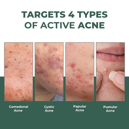 Conscious ChemistÂ® Rapid Relief Acne Spot Corrector Gel | 15g | Triple-Action Treatment with 2% Salicylic Acid & Azelaic Acid | Clears Pimples, Reduces Redness & Fades Dark Spots | For Men & Women