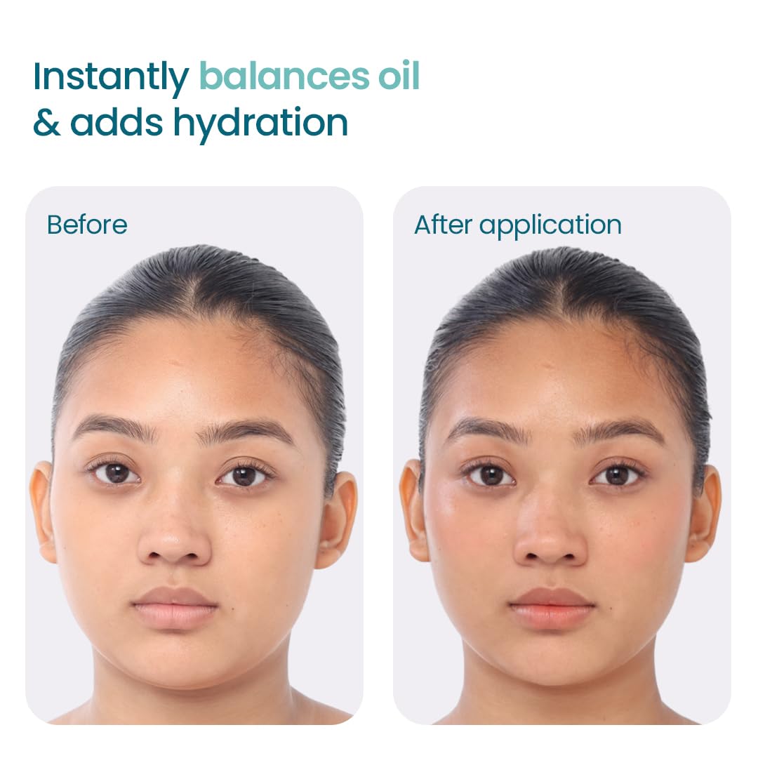 WishCare 2:1:3 NMF Water Gel Moisturizer for Face Oily Skin, Sensitive Skin | Oil-Free Moisturizer Cream For Acne Prone Face | With Niacinamide, Zinc PCA & NMF | Controls Oil & Hydrates | For Men & Women | 50ml