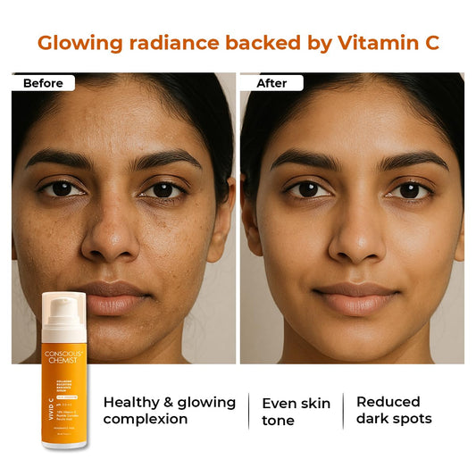 Conscious ChemistÂ® Dull Skin, Dark Circles & Fine Lines Treatment 10% Vitamin C Face Serum | For Glowing Skin | Tested for Oily Skin With Ferulic Acid, Ethyl Ascorbic Acid & PHA | All Skin Types | For Men & Women | 30Ml