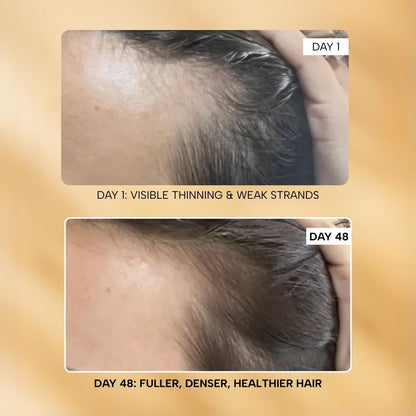 RAS Root-ineâ„¢ Hair Growth Serum with 19.5% Scalp Actives | Redensyl & Anagain | Promotes Hair Growth, Stimulates Hair Follicles & Regrowth | Controls Hair Fall & Increases Hair Density | Hair Growth Serum for Women & Men
