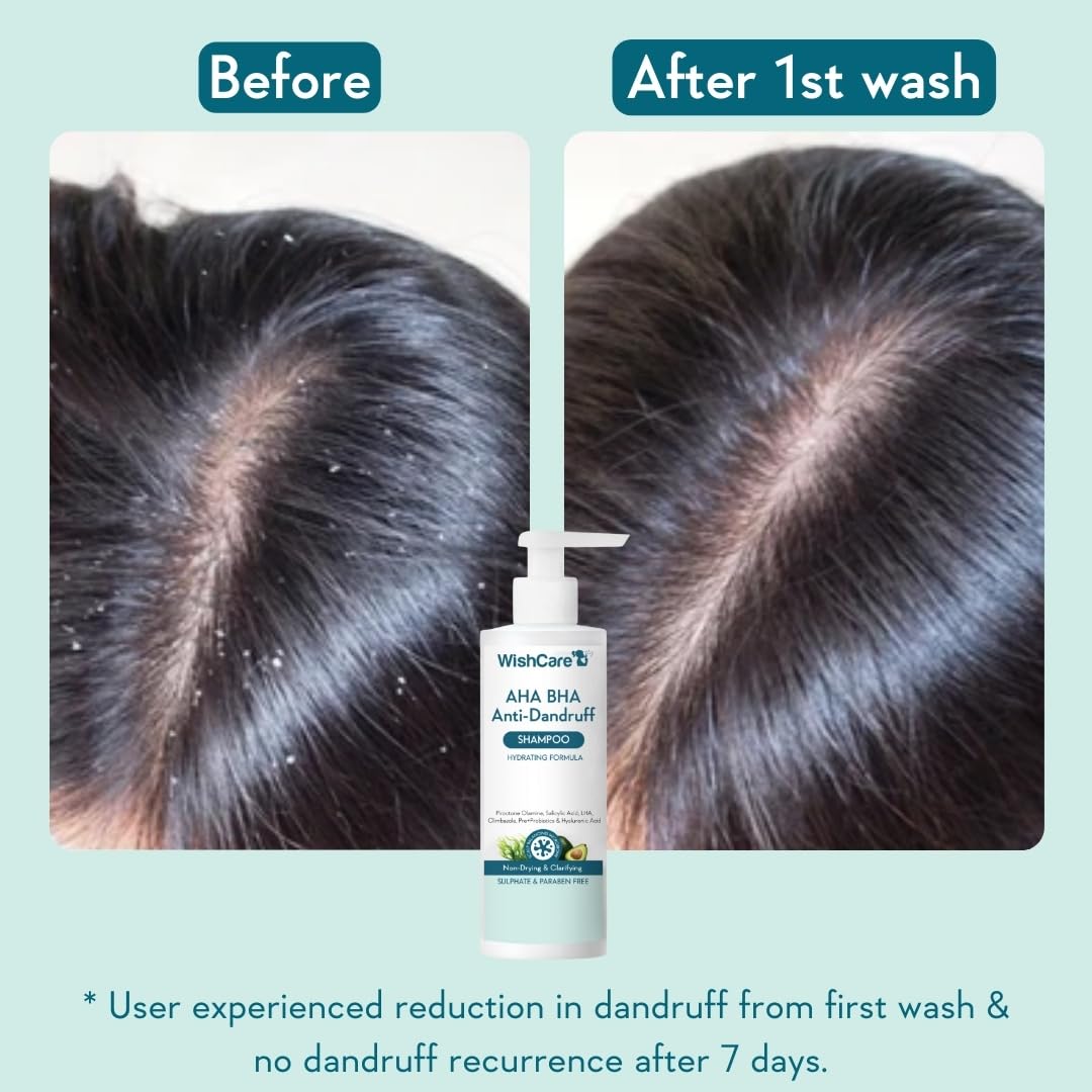WishCare Hydrating Anti Dandruff Shampoo | 100% Dandruff Reduction | Removes Flakes & Hydrates Scalp | Proven Clinically | Piroctone Olamine, Salicylic Acid, AHA & BHA | Paraben & Sulphate Free | For Women And Men | 250ml