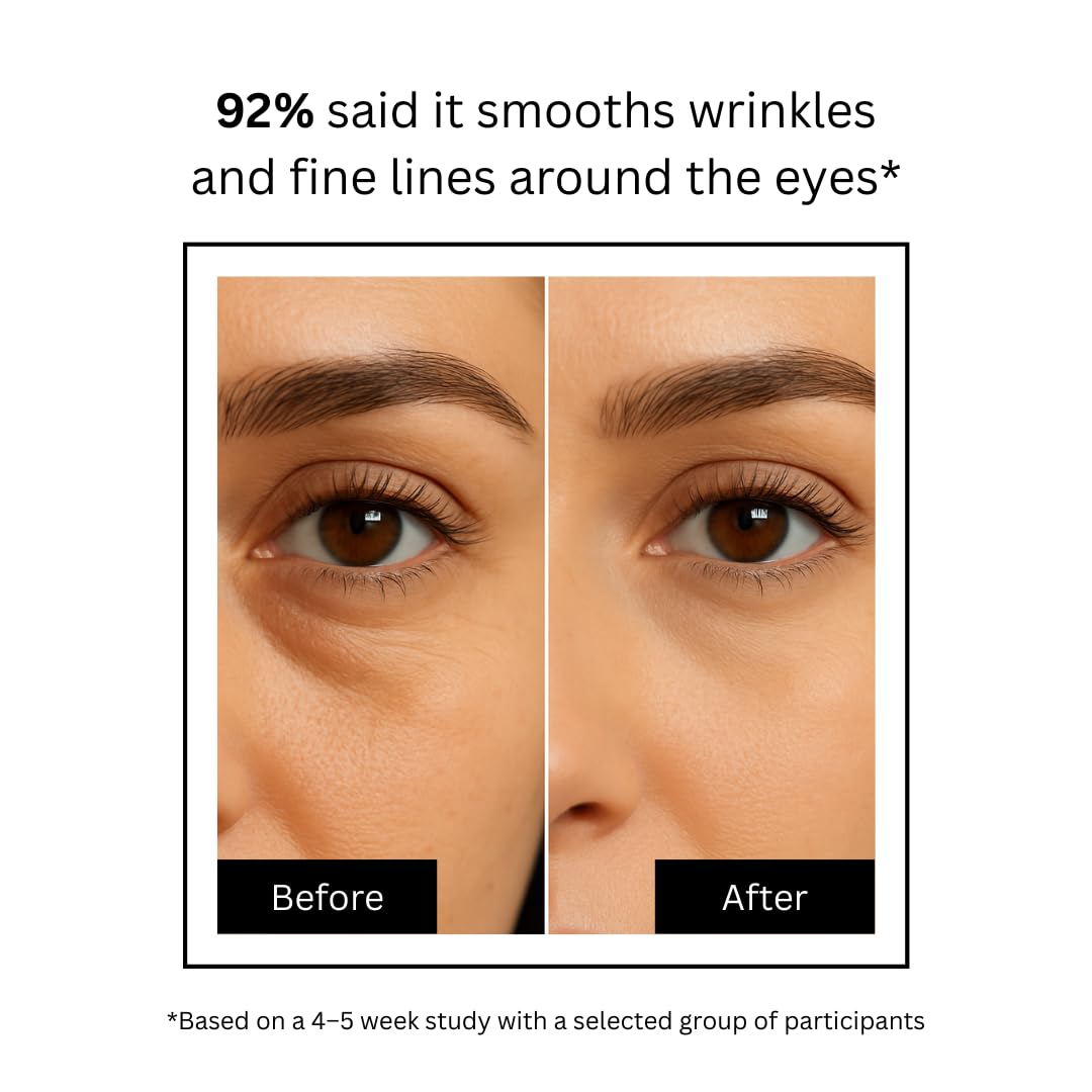 Brilliance Advance Under Eye Serum for Dark Circles & Puffiness â€“ Hydrating Anti-Aging Formula with Peptides,Niacinamide & Hyaluronic Acid | Dermatologist Tested | 15gm