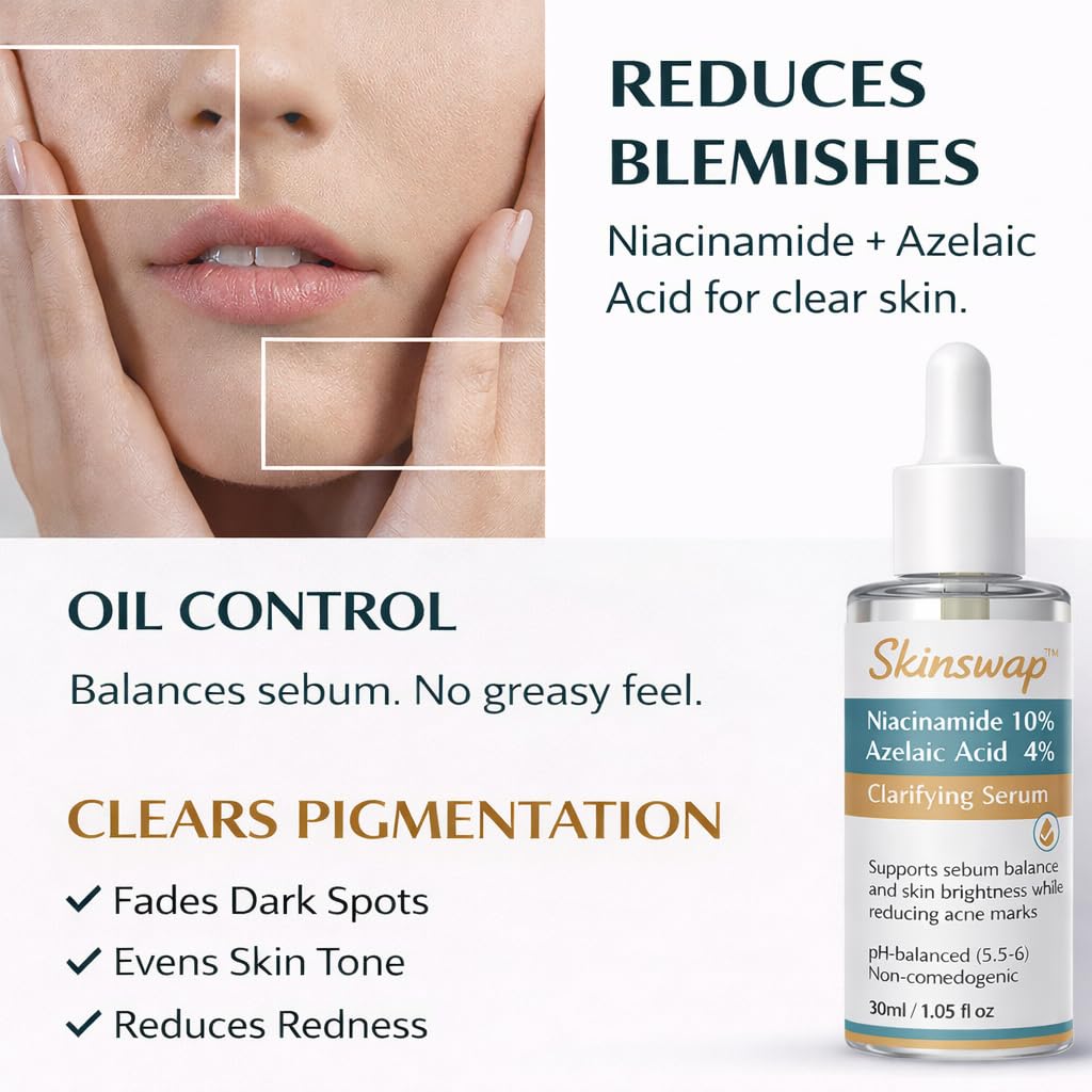 Skinswap Active 14% Niacinamide Serum with Azelaic Acid | Clarifying Face Serum for Brightening & Oil Control | Helps Reduce Acne, Blemishes & Acne Marks | Smooth, Clear-Looking Skin | For Women & Men | 30 ml