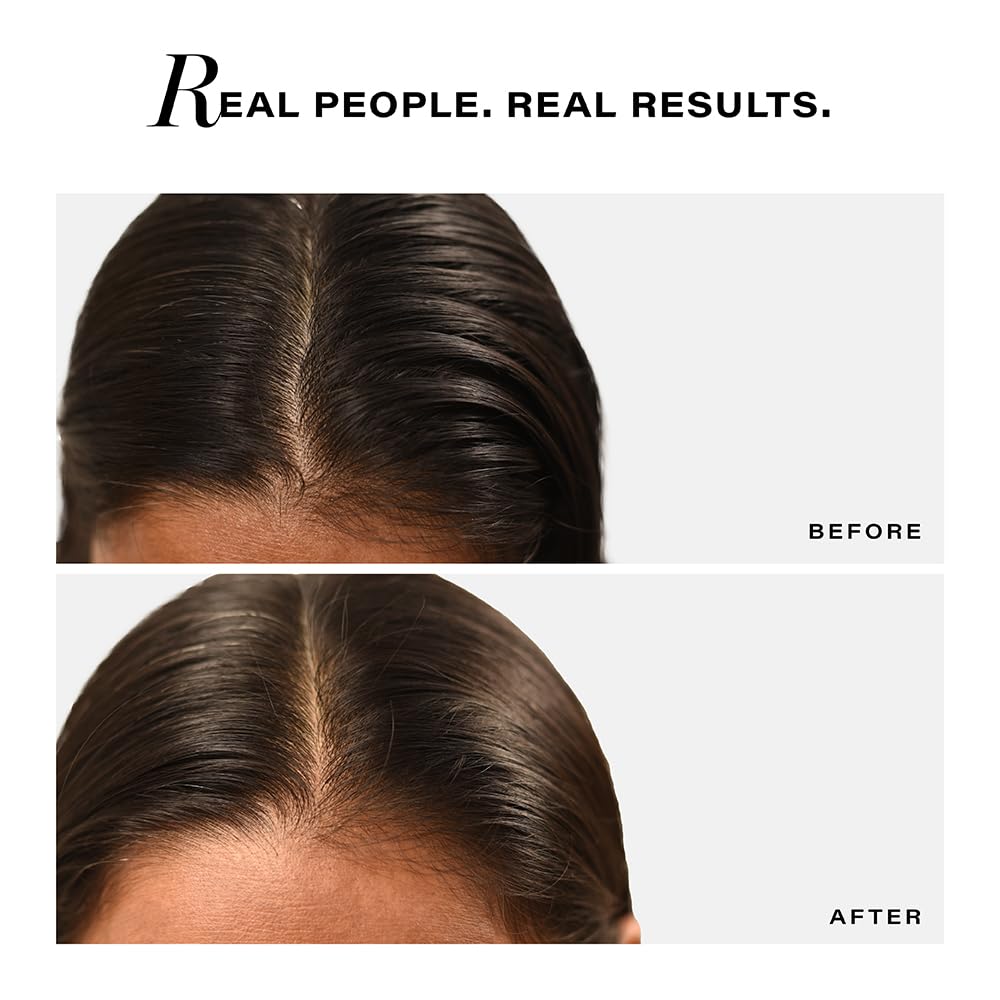 Novology Sebosys Control Scalp Serum for 48hrs Oil Control with 1% Capryloyl, Salicylic Acid, Niacinamide| Targets greasy hair and itchy scalp | 50ml