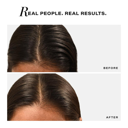 Novology Sebosys Control Scalp Serum for 48hrs Oil Control with 1% Capryloyl, Salicylic Acid, Niacinamide| Targets greasy hair and itchy scalp | 50ml