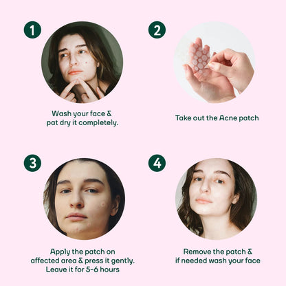 MOUNTAINORÂ® Acne Pimple Patch - Hydrocolloid + Tea Tree Oil Potent Spot Cover, Fast Breakout Healing, Overnight Removal of Acne Gunk, Waterproof Invisible Patches, Safe & Certified 36 Patches.