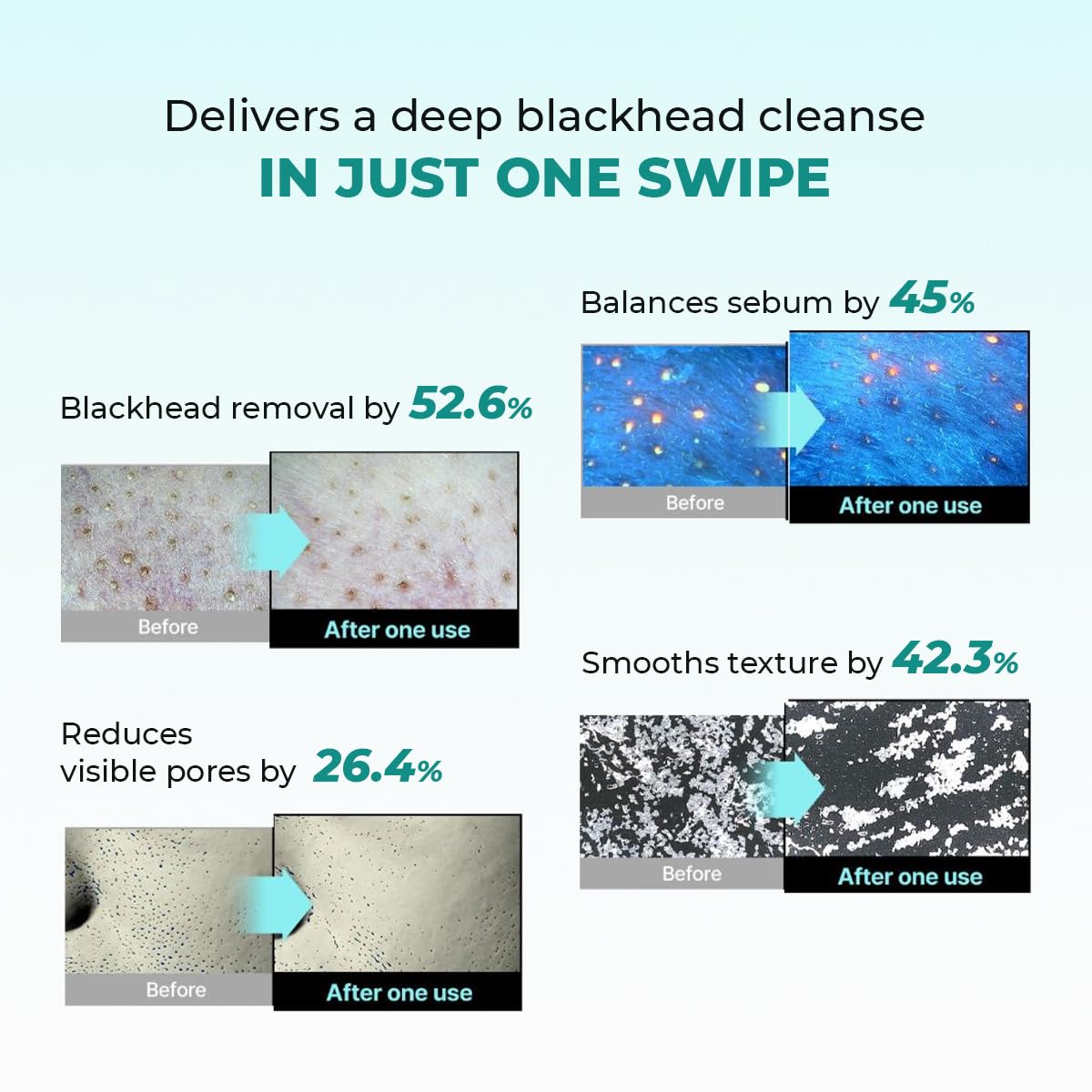 Conscious ChemistÂ® Blackhead Melting Water 130ml + Silicone Brush | Gentle Pore Treatment with Succinic, Glycolic Acid & CICA Exosome | Unclogs Pores, Removes Blackheads & Smoothens Skin | For Men & Women