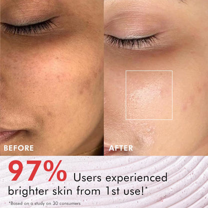 mcaffeine Berries Brightening Coffee Face Scrub For Glowing Skin | Gently Exfoliates, Smoothes & Improves Skin Tone | Removes Tan&Dead Skin | Tan Removal Face Scrub | Non-Drying For Women & Men-75Gm