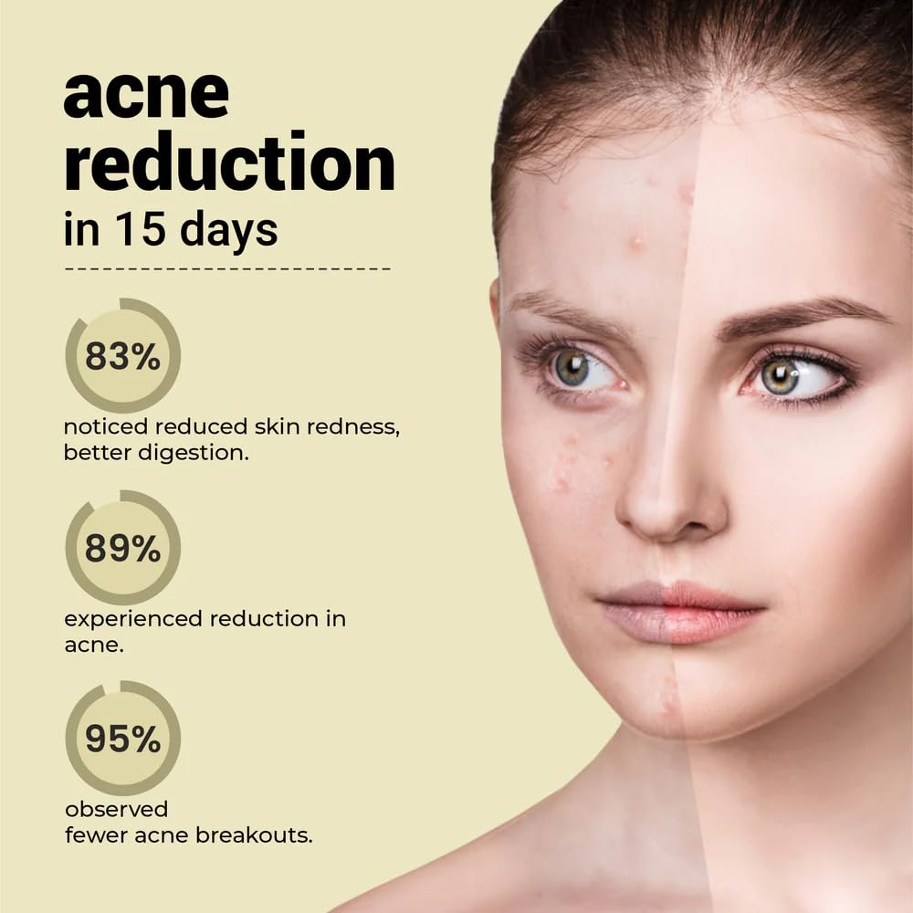Cureveda SkinGut Pre & Probiotic Powder for Clear Skin | Supports Acne Control | Gut Health| Skin Detox | Plant-Based Formula with Antioxidants | No Added Sugar & Artificial Flavour(150 gm)