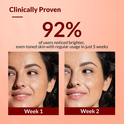 Fixderma Tranexamic Acid + 2% Kojic Acid + 1% Arbutin SKARFIX -TX Face Cream | Pigmentation Removal Cream | Kojic Acid | Uneven Skin Tone - 15 gm (Pack of 1)