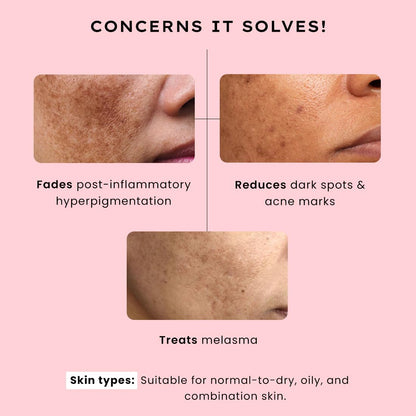 Hyphen 4% Tranexamic Acid + 5% Niacinamide Biphasic De-Pigmentation Serum | Correction & Prevents Hyperpigmentation, Dark Spots & Melasma| In-vivo tested & Non-Comedogenic| Deep Penetration - 30 ml