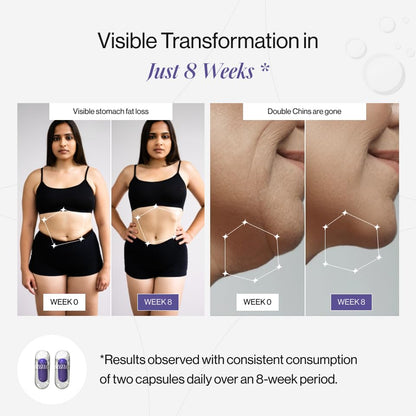 Beautywise Dual Action Body Shape | Weight Management | Helps Convert Fat into Energy Supplement for Men & Women (30 Capsules)