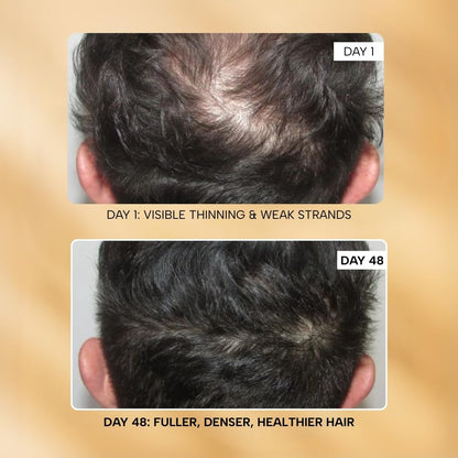 RAS Root-ineâ„¢ Hair Growth Serum with 19.5% Scalp Actives | Redensyl & Anagain | Promotes Hair Growth, Stimulates Hair Follicles & Regrowth | Controls Hair Fall & Increases Hair Density | Hair Growth Serum for Women & Men