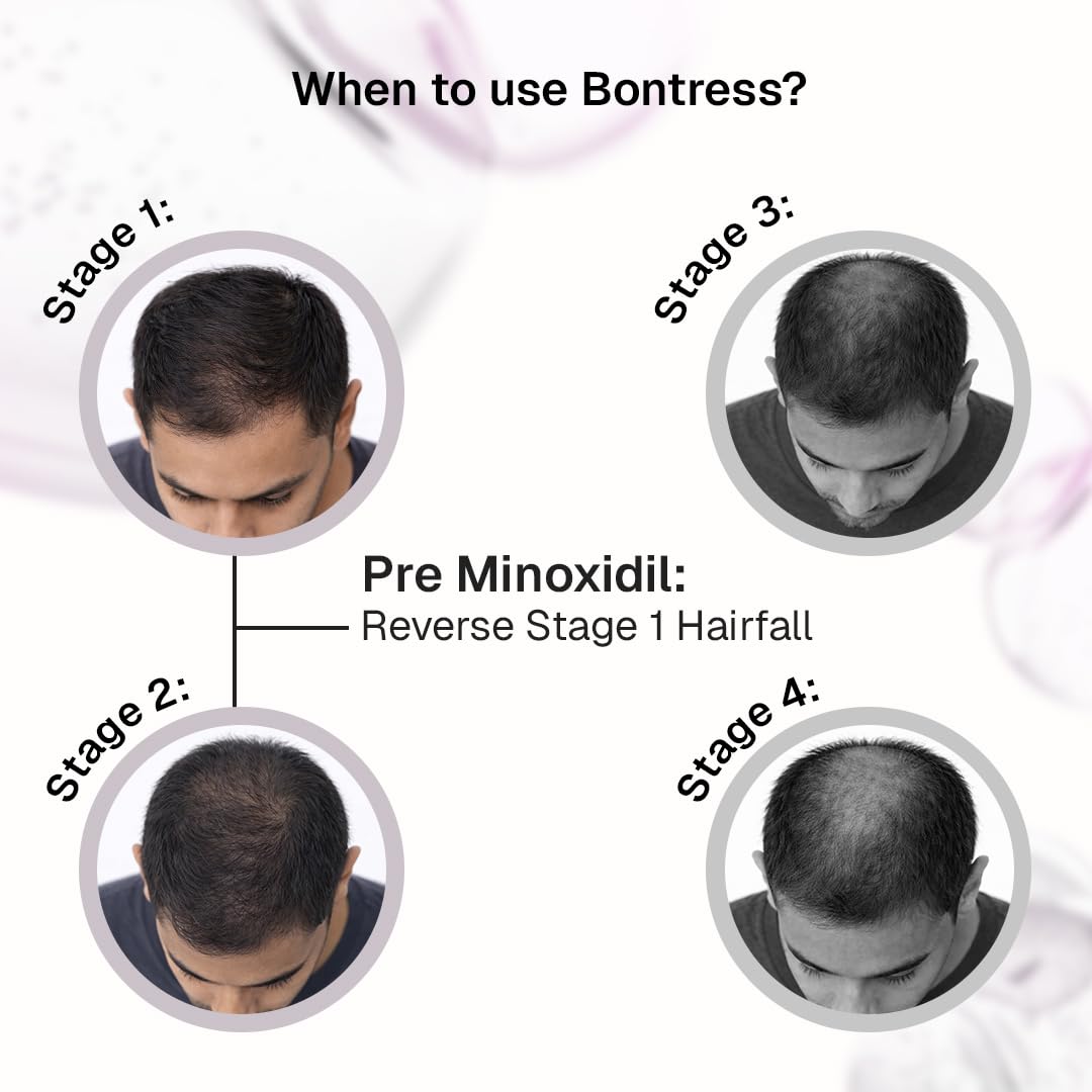Bontress PRO+ Scalp Serum | Powered by Pro Active Peptides â€“ 5% Capixyl, 3% Redensyl, 3% Anagain, 3% Procapil | Dermat recommended Hair Growth Serum | 94% Users Reported Hair Growth in 28 Days | 30ml