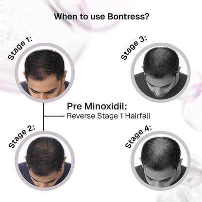 Bontress PRO+ Scalp Serum | Powered by Pro Active Peptides â€“ 5% Capixyl, 3% Redensyl, 3% Anagain, 3% Procapil | Dermat recommended Hair Growth Serum | 94% Users Reported Hair Growth in 28 Days | 30ml