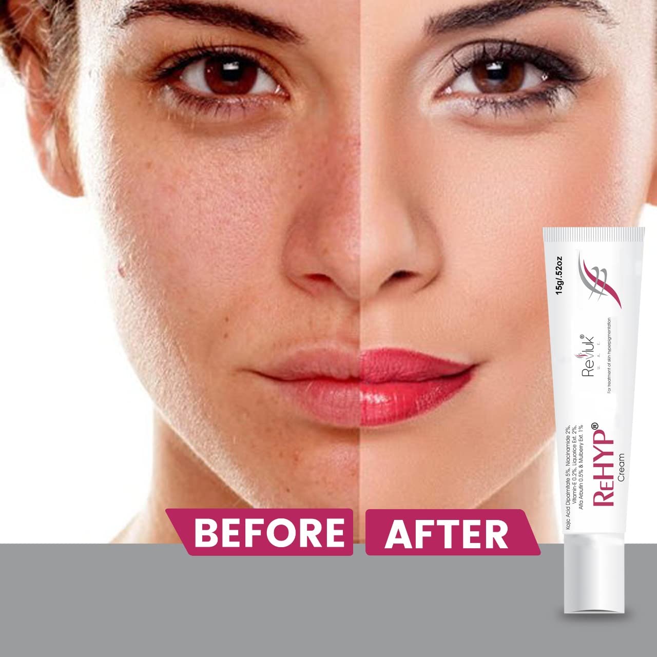 Rehyp Pigmentation Cream for Women â€“ Dark Spot Remover, Brightening Face Cream with Kojic Acid & Alpha Arbutin â€“ Paraben-Free, Dermatologically Tested â€“ 15g