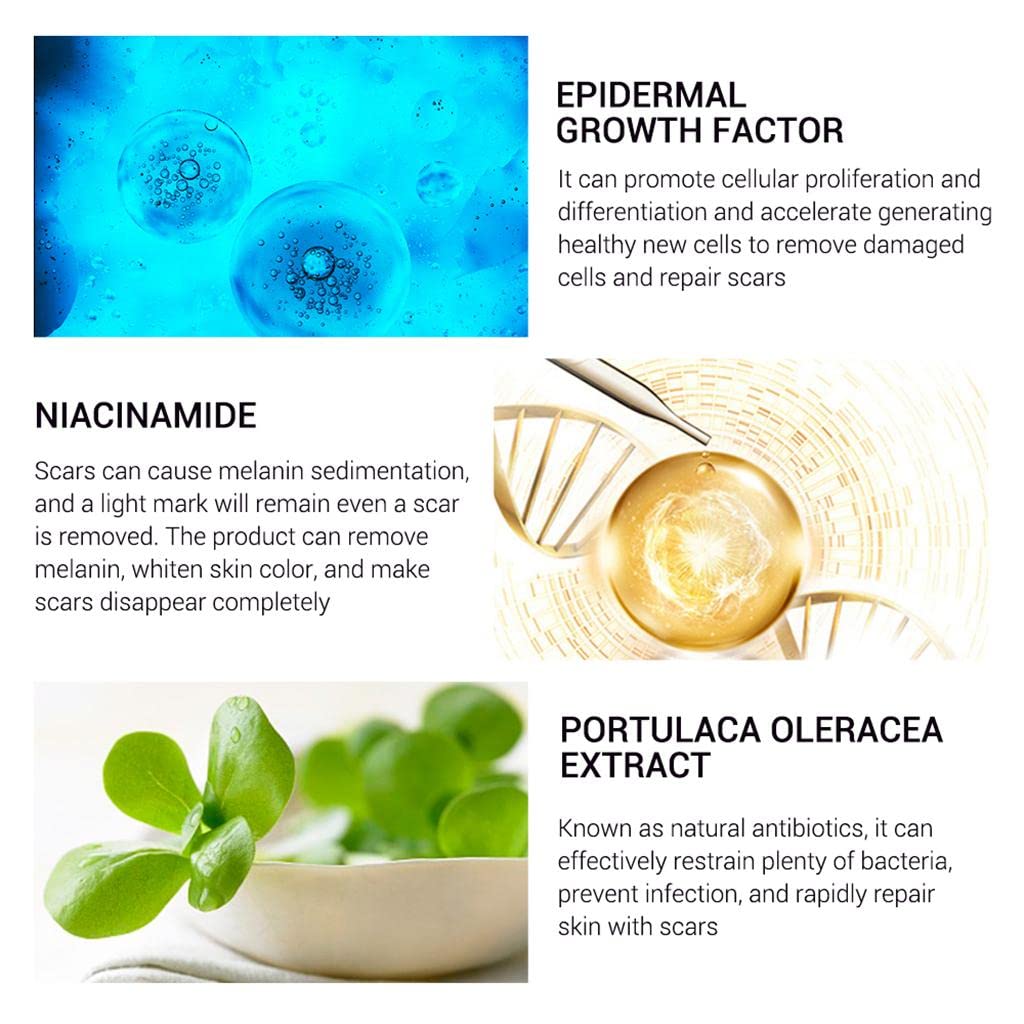 CLUB BOLLYWOODÂ® Removal Scar Cream Face Pimples Scar Stretch Marks Removal Acne Treatment | Bath & Body | Scar & Stretch Mark Reducers