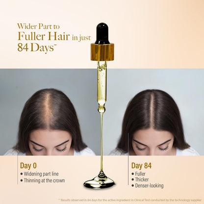 Kesh King Gold Advanced Hair Growth Serum â€“ 21% Growth Actives with 3% Redensyl, 3% Anagain, Procapil, Kopexil Aqua & Ayurvedic Herbs | Visible Regrowth & Hair Fall Control | Women & Men | 30ml