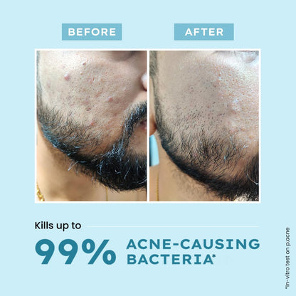 Hyphen Clarifying Acne Face Wash for Women and Men | Cleanser For Acne Prone Skin with Salicylic Acid 2%, Zinc PCA, Witch Hazel 10% | Oil Control Pore Cleasning | Antibacterial & Non-Drying - 100ml