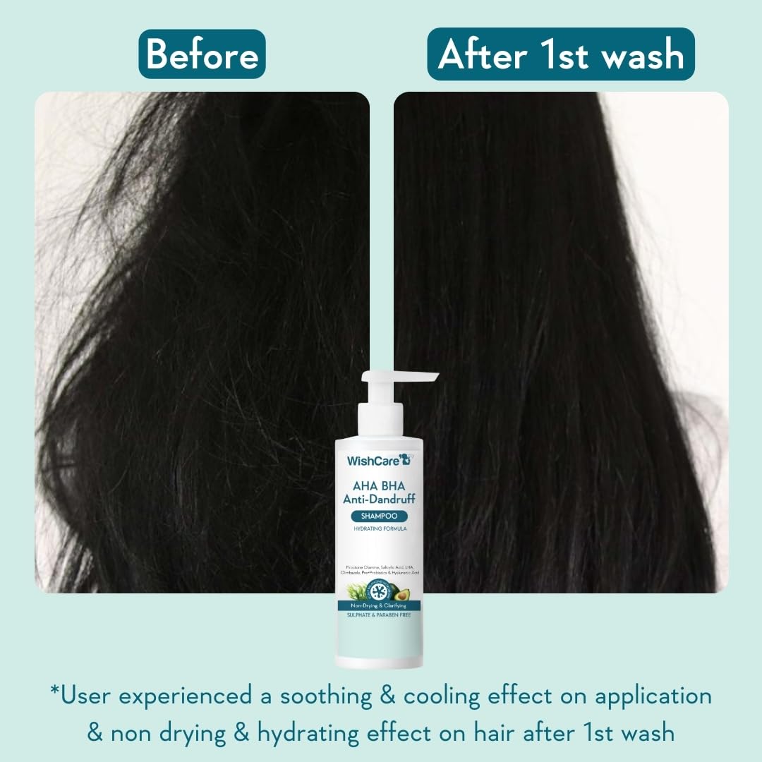 WishCare Hydrating Anti Dandruff Shampoo | 100% Dandruff Reduction | Removes Flakes & Hydrates Scalp | Proven Clinically | Piroctone Olamine, Salicylic Acid, AHA & BHA | Paraben & Sulphate Free | For Women And Men | 250ml
