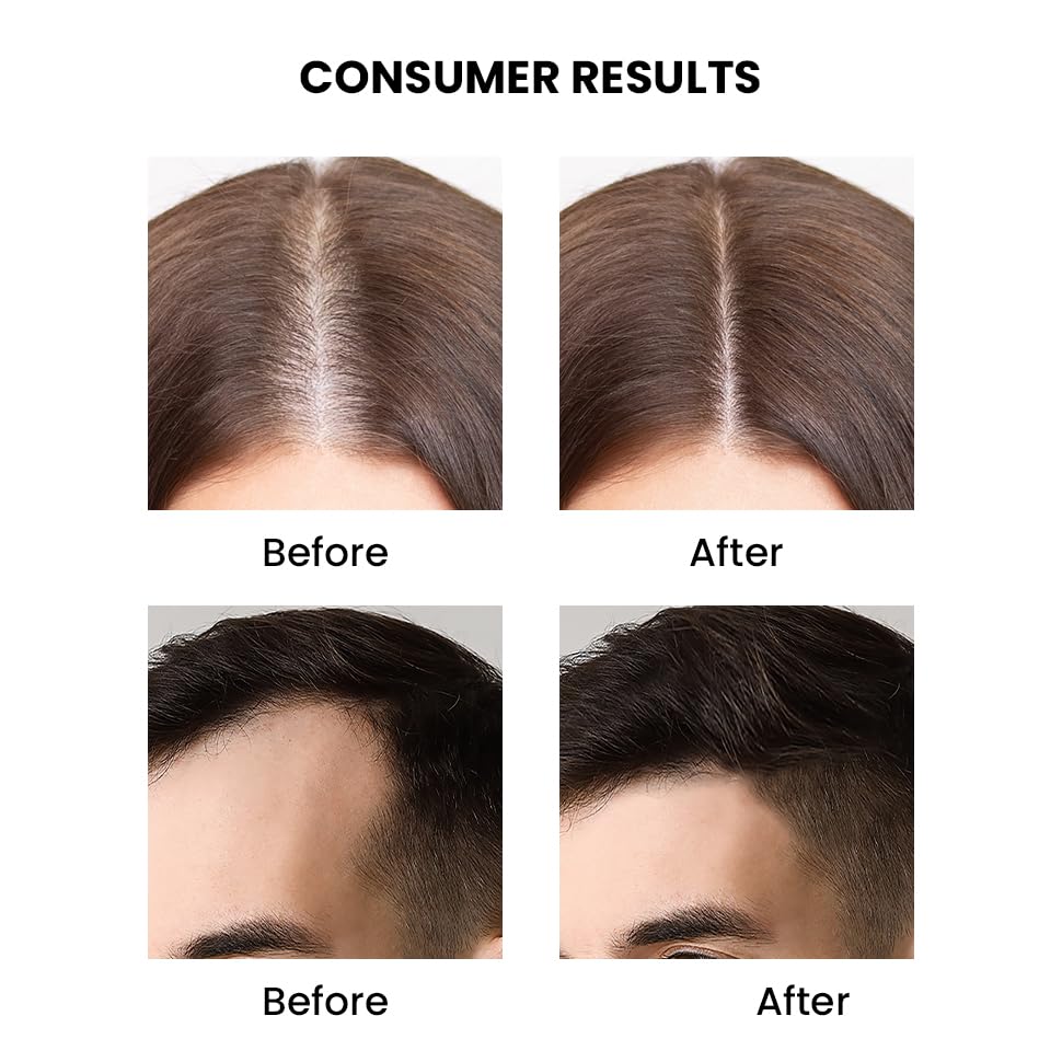 ThriveCo Rosemary Essential Oil | Helps Promote Hair Growth & Control Hair Fall | 100% Pure & Organic | With Vitamin E | Strengthens Hair & Supports Scalp Health | For Men & Women | 15 ml