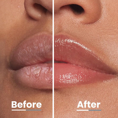 Hyphen-Vitamin Infused Peptide Lip Balm-Vanilla for Dry & Chapped Lips|Hydrating & Moisturizing Lip Balm for Unisex|for Dark Lips|Smoothen Lips & Repair Moisture Barrier|Vegan,SLS & Parabens Free|10gm