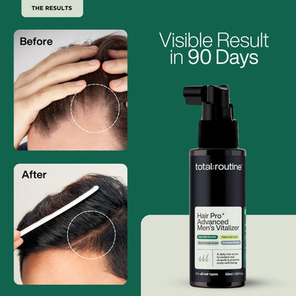 Total Routine Hair Serum for Men - Advanced Formula with 3% Redensyl, 3% Procapil, 4% Capixyl, Saw Palmetto, Collagen & Peptides for Hair Growth & Hairfall Control (50ml - Large)