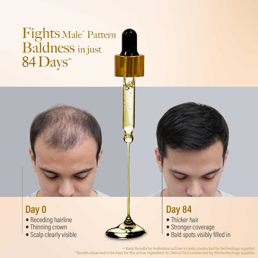 Kesh King Gold Advanced Hair Growth Serum â€“ 21% Growth Actives with 3% Redensyl, 3% Anagain, Procapil, Kopexil Aqua & Ayurvedic Herbs | Visible Regrowth & Hair Fall Control | Women & Men | 30ml