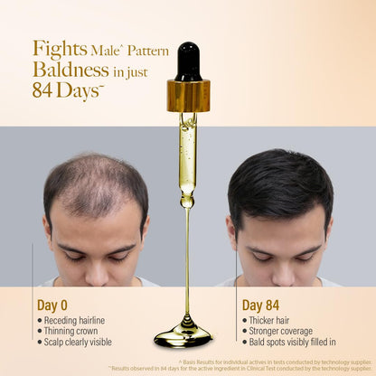 Kesh King Gold Advanced Hair Growth Serum â€“ 21% Growth Actives with 3% Redensyl, 3% Anagain, Procapil, Kopexil Aqua & Ayurvedic Herbs | Visible Regrowth & Hair Fall Control | Women & Men | 30ml